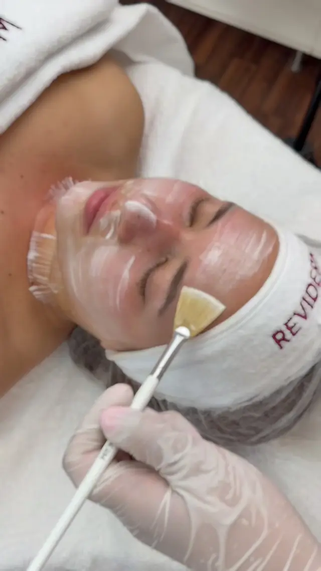 Fruchtsäure-Peeling bei Amina Beauty Studio